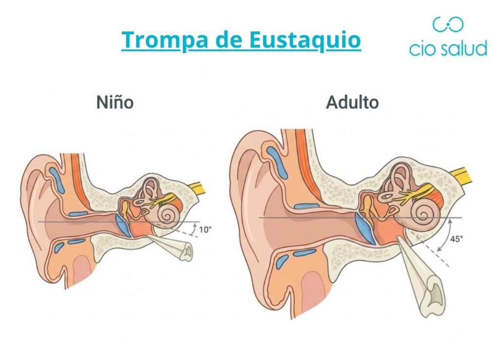 dolor de oídos en niños