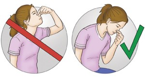 postura-hemorragia-nasal