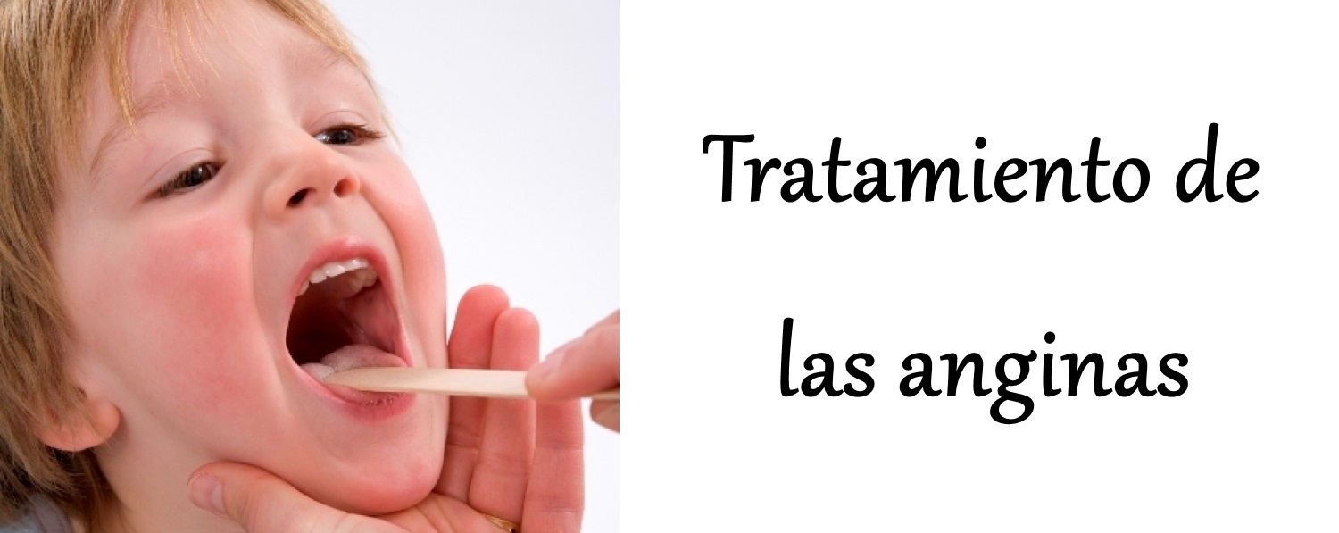 anginas-tratamiento