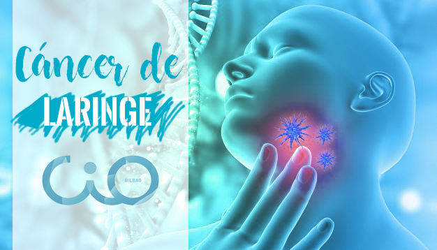 cáncer de laringe