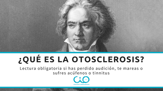 ¿Qué es la otosclerosis?