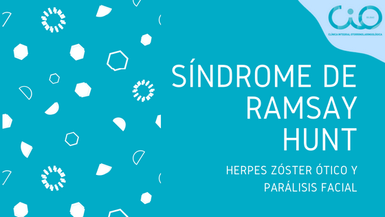 síndrome de ramsay hunt