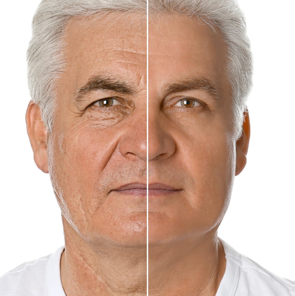 rejuvenecimiento facial hombre