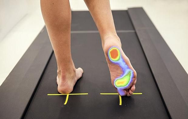 plantillas fascitis plantar
