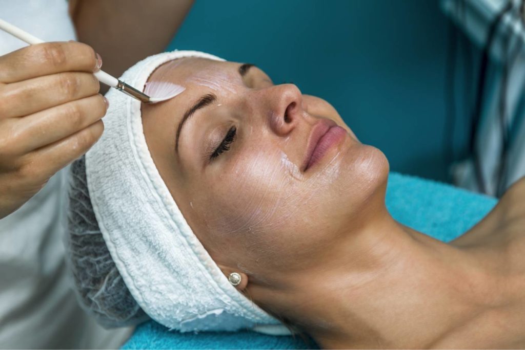 beneficios peeling facial