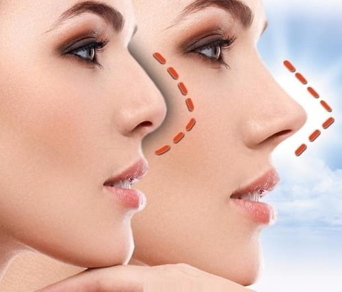 rinoplastia estética funcional Vizcaya
