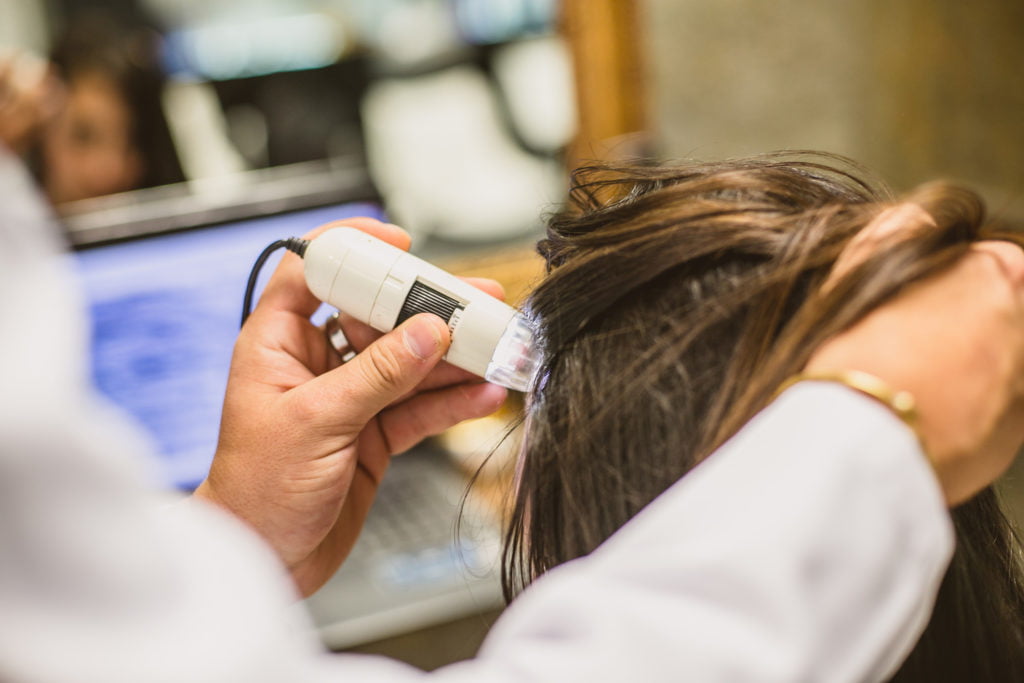 tratamiento alopecia femenina
