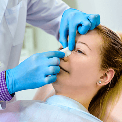 beneficios rinoplastia estética