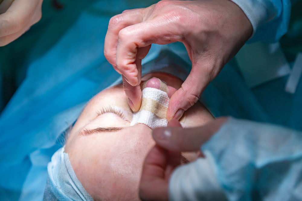 posoperatorio rinoplastia tabique nasal