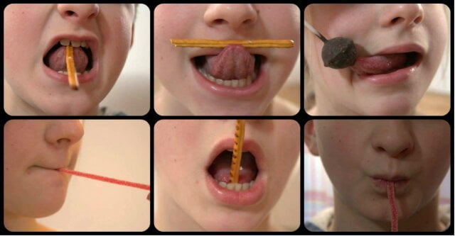 ejercicios reeducación lengua dientes