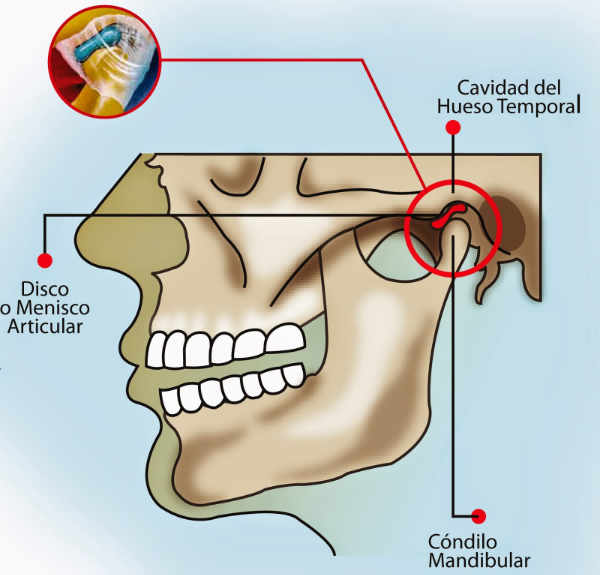 fisioterapia ATM Bilbao Vizcaya