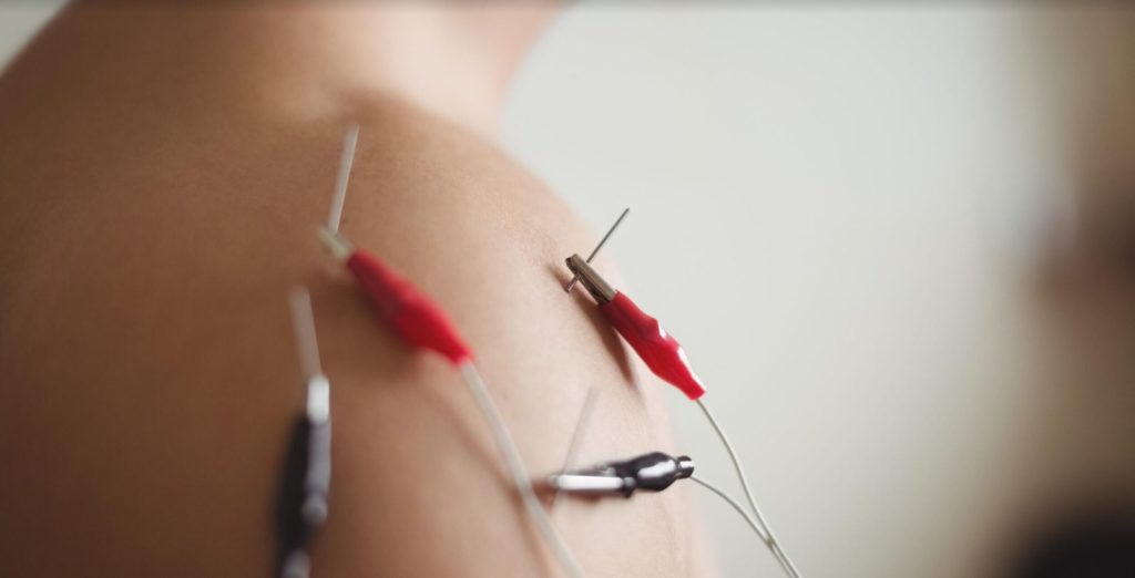 terapia cervical Bilbao