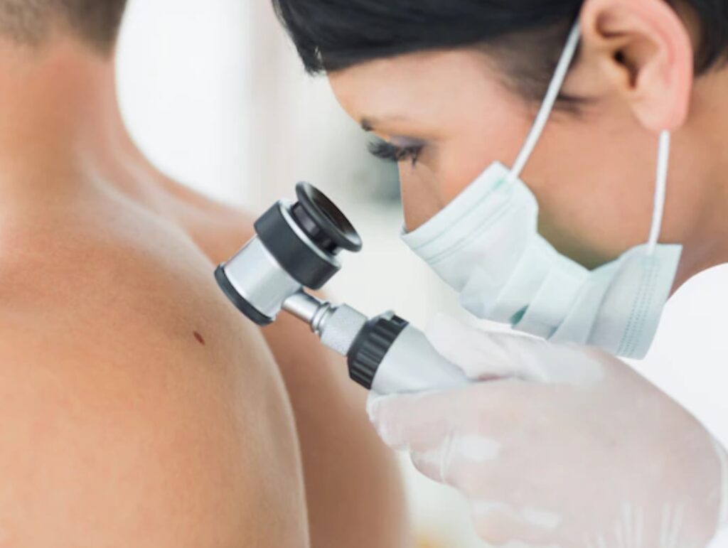 cáncer de piel y tratamiento