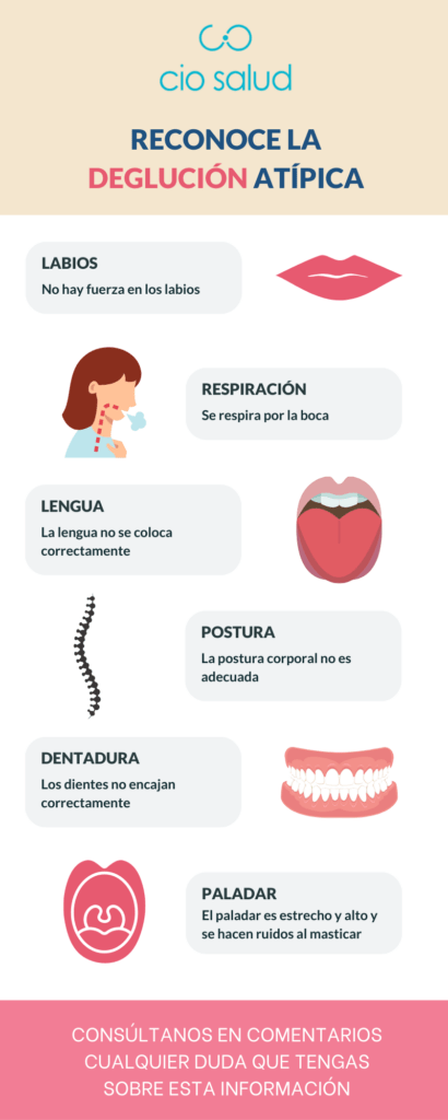 Infografía Reconocer la deglución atípica
