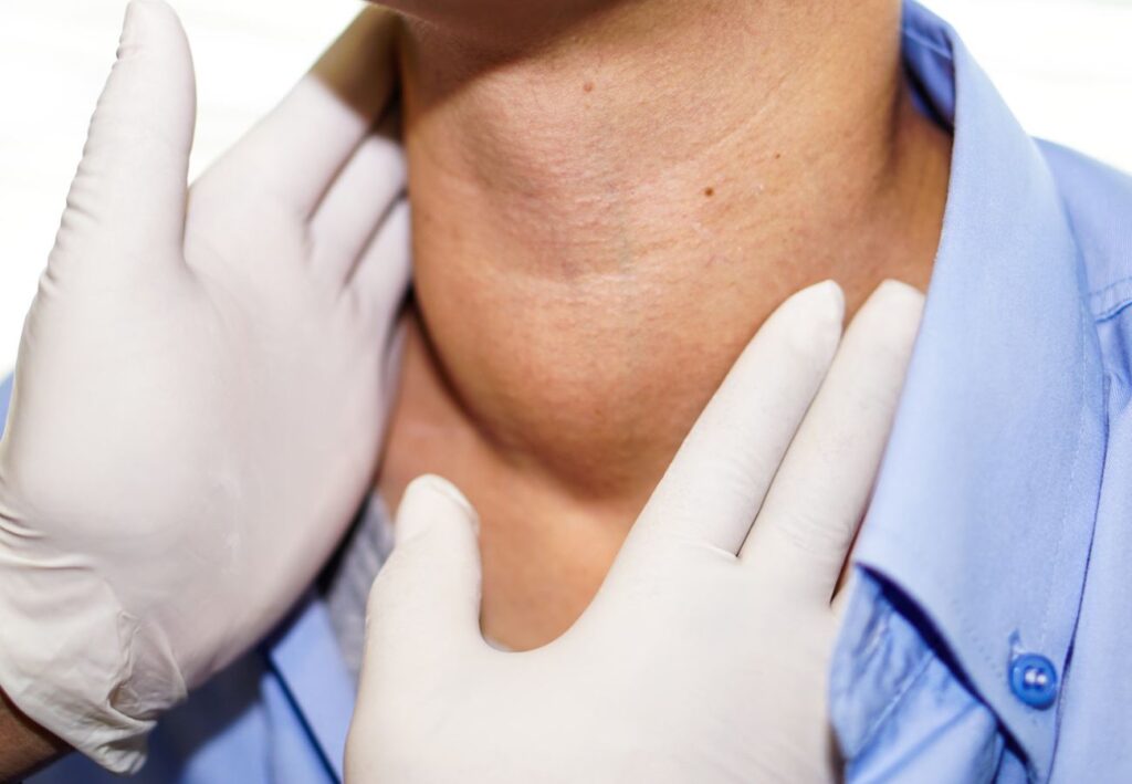 Sialoadenitis obstructiva crónica