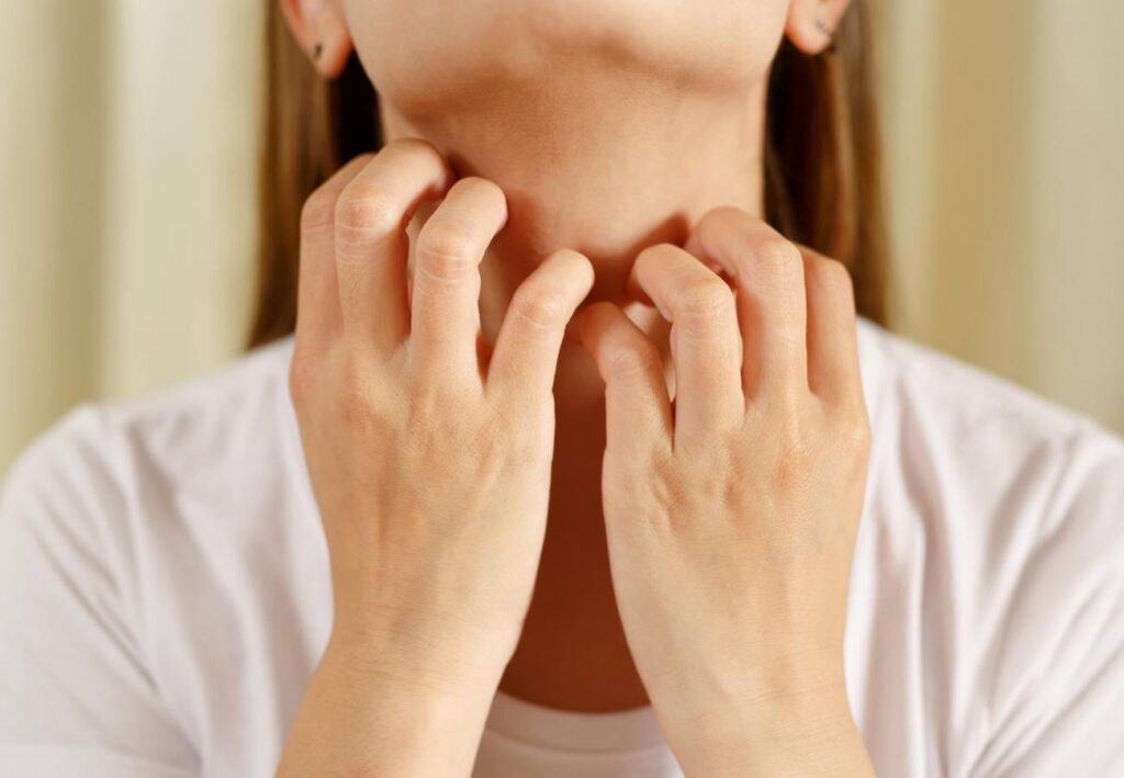 piel sensible dermatología