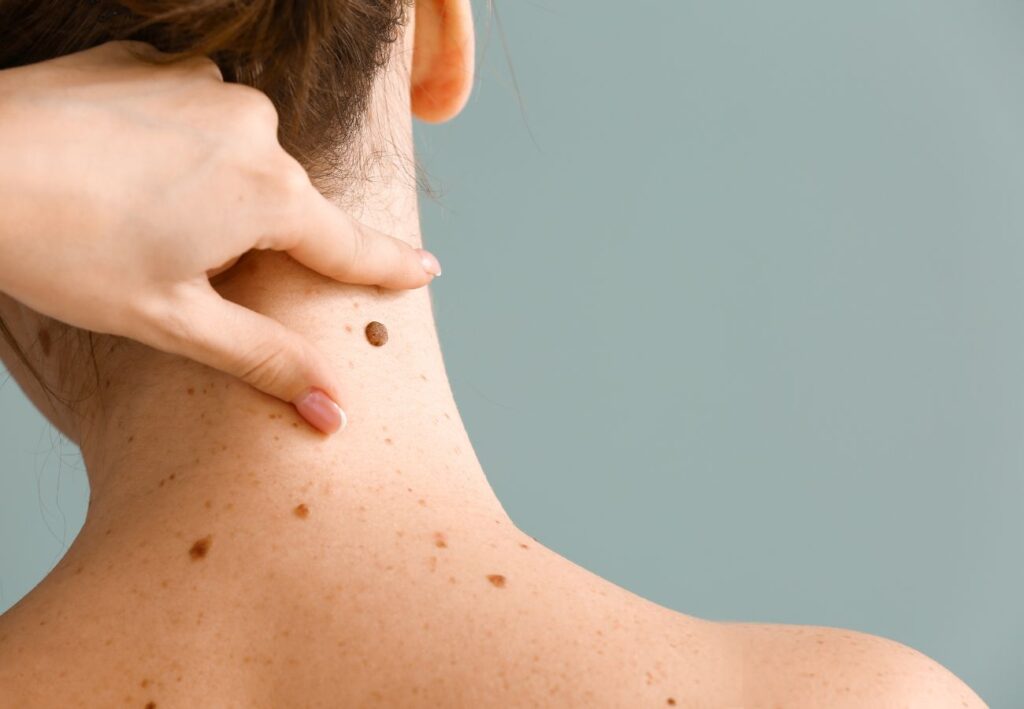 diferencias dermatología y venereología