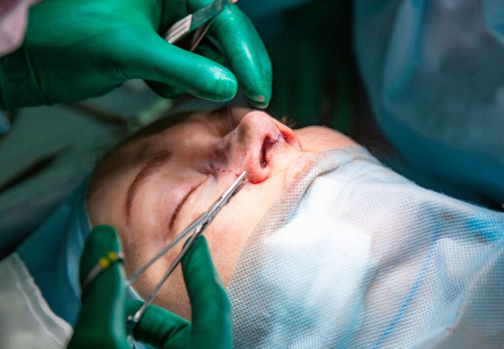 rinoplastia