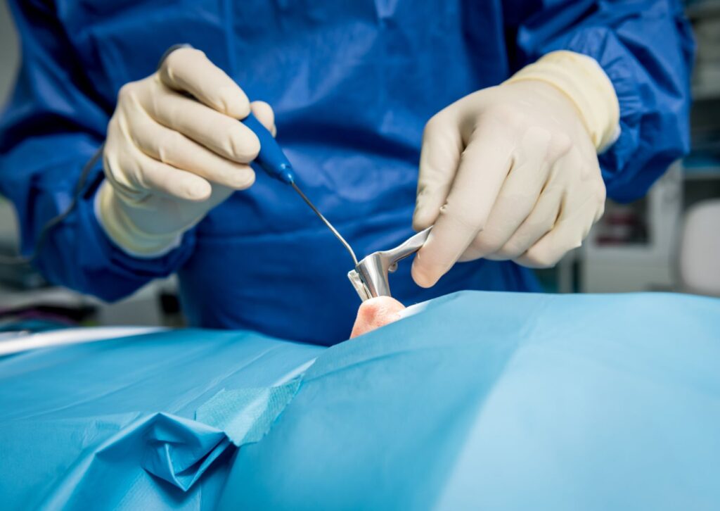 cirugía nasal correctiva