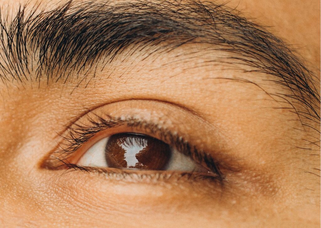 dermatitis seborreica